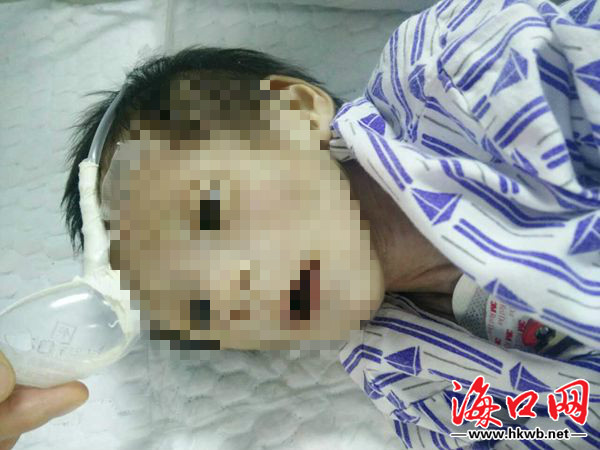 急诊室抢救心跳骤停的视频,病人突发心跳骤停护士应怎么抢救