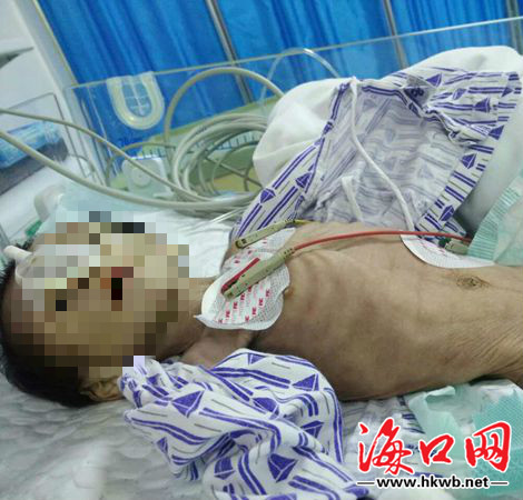 急诊室抢救心跳骤停的视频,病人突发心跳骤停护士应怎么抢救