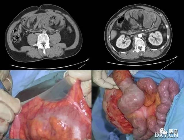 消化系统钡餐造影的直接征象,消化系统影像学诊断手册基础知识