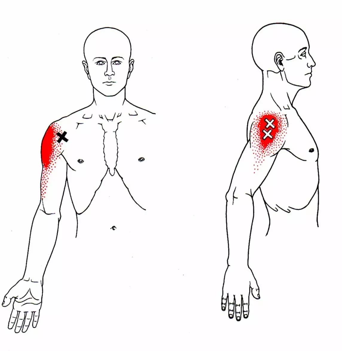 99%的上班族都“坐”出了工伤，你中枪了吗？