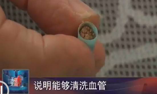 神奇保健品的骗局,保健品胶囊骗人