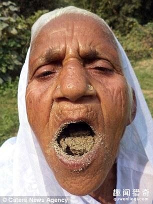 吃美沙上瘾如何戒掉,吃美沙上瘾怎样戒掉