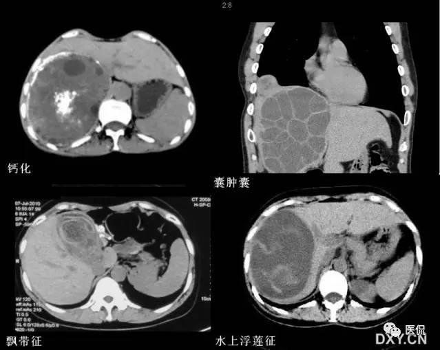 消化系统钡餐造影的直接征象,消化系统影像学诊断手册基础知识