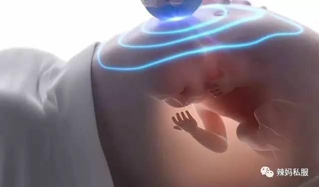 孕检查五项是什么意思,孕检哪些是一定要查的