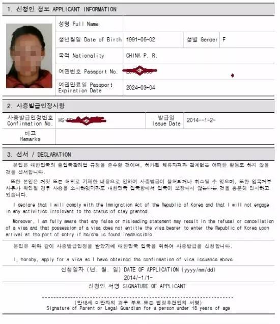 双眼皮手术韩式整形,韩国医生做幽灵手术