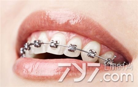 拔牙后注意事项最全,拔牙后注意事项全知道