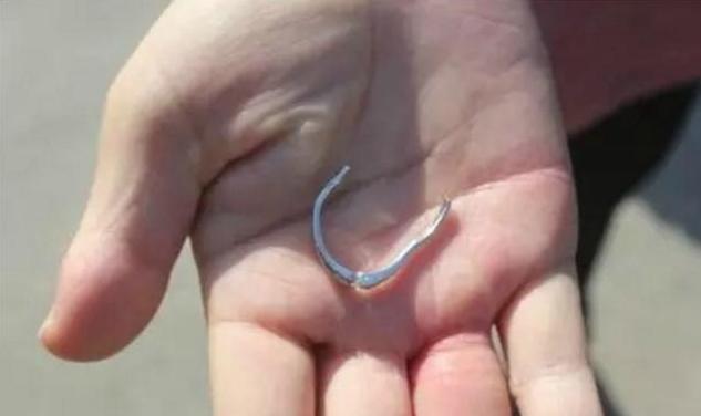 怀孕手肿钻戒指拿不下来怎么办 (怀孕后期手肿戒指戴不下去)