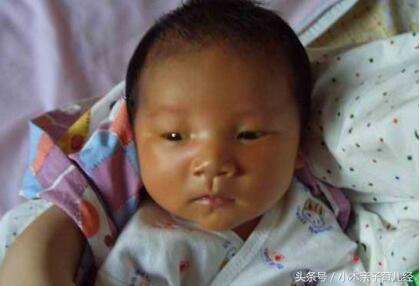 孩子被送医院治疗黄疸,刚出生的孩子有黄疸偏方