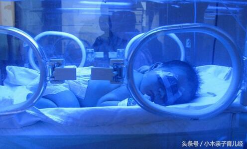 孩子被送医院治疗黄疸,刚出生的孩子有黄疸偏方