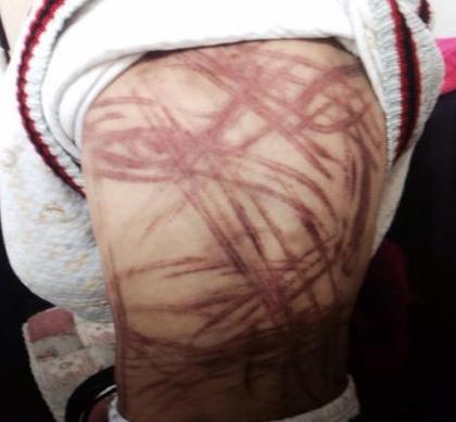 男孩疯狂自虐，浑身伤痕累累，一切都是为了妈妈