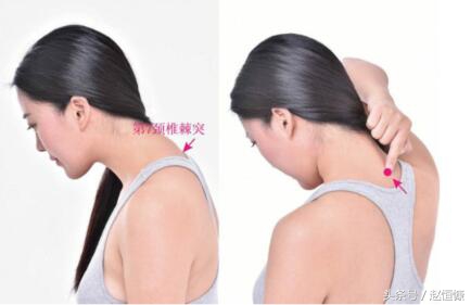 颈肩部疼痛取穴,颈痛穴和腰痛穴