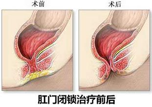 医生开玩笑对怀孕的护士说“你生孩子没*眼屁**!”,没想到一语成谶