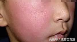 东川红土地距离元谋土林有多远,元谋土林东川红土地