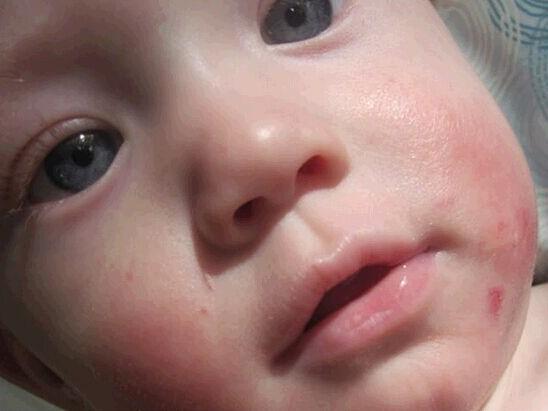 秋冬季节如何保护宝宝的皮肤,儿童冬天怎么保护皮肤