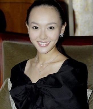 哪些女星整过发际线,发际线最惊人的女星