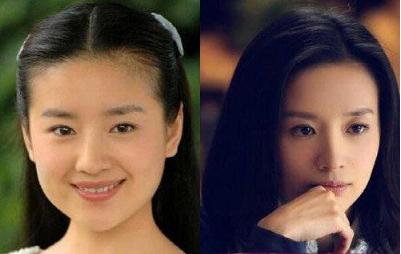 哪些女星整过发际线,发际线最惊人的女星