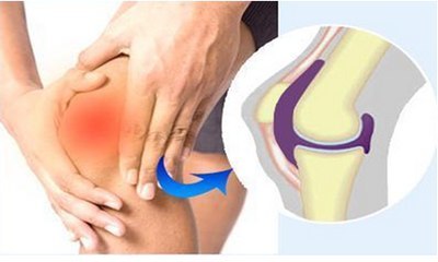 天冷不注意保暖容易得关节炎,因为冻导致的关节炎是什么关节炎