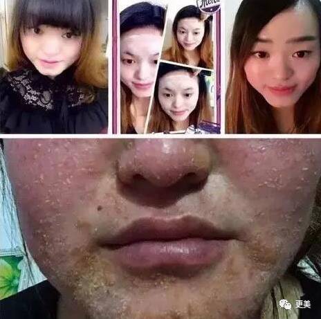 卖劣质面膜的明星,明星卖假化妆品后续