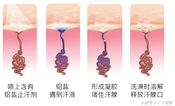科普一个鲜为人知的事实：有狐臭是正常的没狐臭才是....