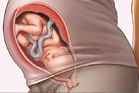 一般怀孕胎儿入盆后多久会出生,女人怀孕后什么时候才会生孩子