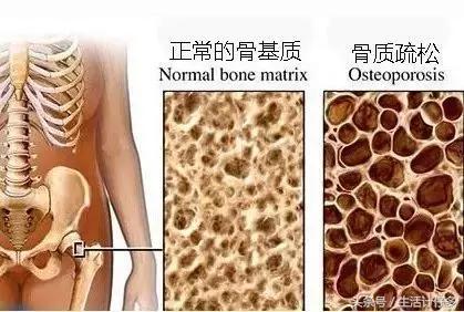 不到十块钱,护骨补钙秒杀牛奶,还富含矿物质!