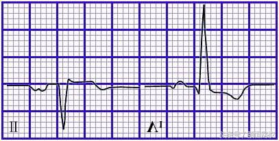 郭雅卿心电图讲解全集,郭雅卿心血管视频课