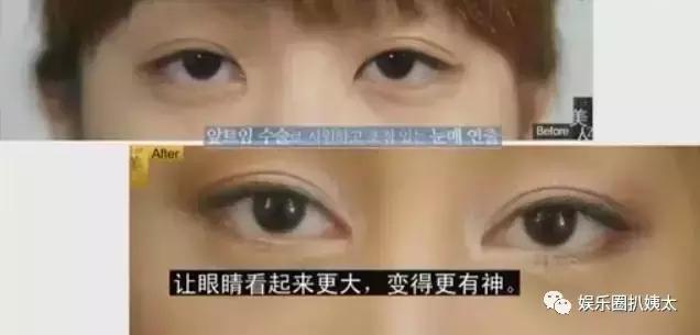 泰国专门的整容节目,泰国的整容节目有哪些