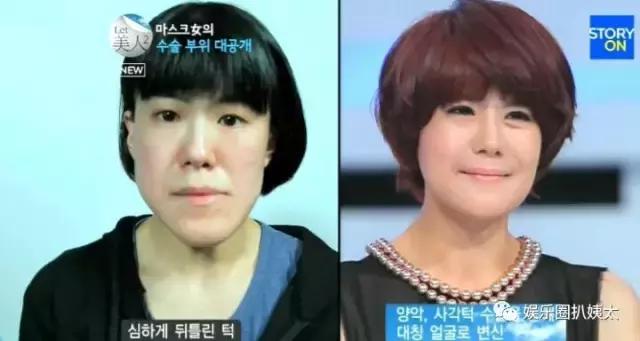 泰国专门的整容节目,泰国的整容节目有哪些