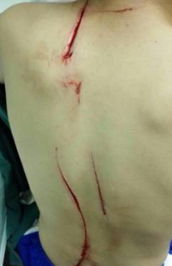 男孩疯狂自虐，浑身伤痕累累，一切都是为了妈妈