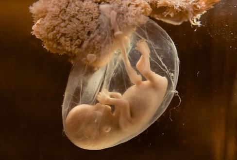 羊水的本质是什么,羊水的相关知识链接