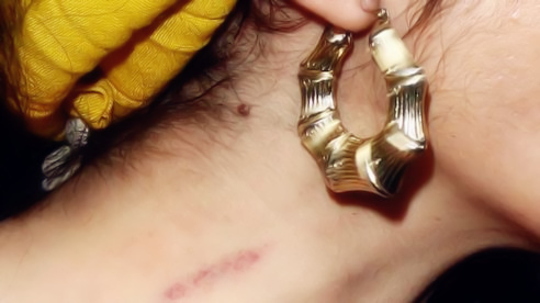 种完“草莓”不想虐狗?3min去除吻痕技能get√