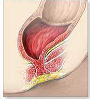 医生开玩笑对怀孕的护士说“你生孩子没*眼屁**!”,没想到一语成谶