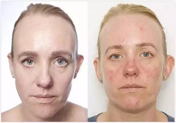 雾霾天卸妆清洁 (雾霾天卸妆的正确方法)