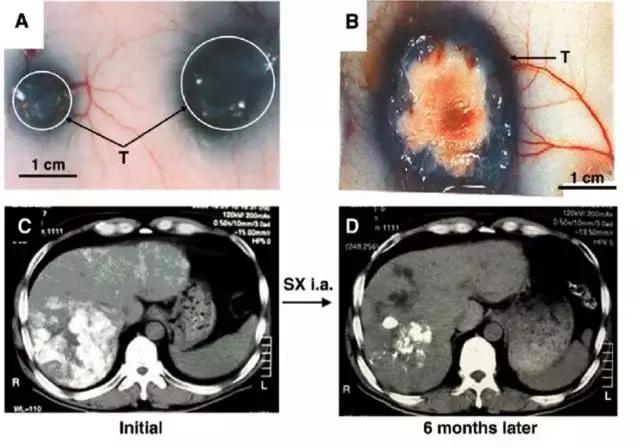 最新日本专家研制的抗癌药,日本抗癌科学家们