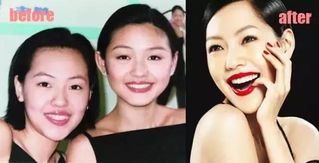 整牙=整容？看杨幂、刘涛、高圆圆为你亲身示范！