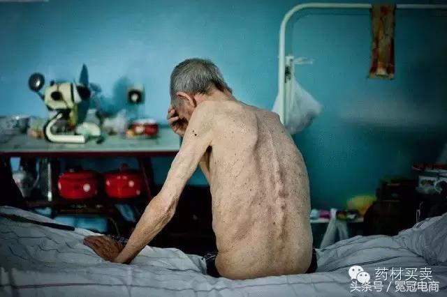 三分治，七分养！十大“健康”养肺中药，让你远离结核病！