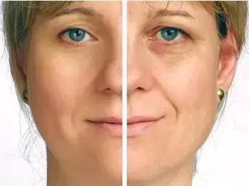 眼周有细纹用什么眼霜好用,护理眼周先用眼精华还是先用眼霜