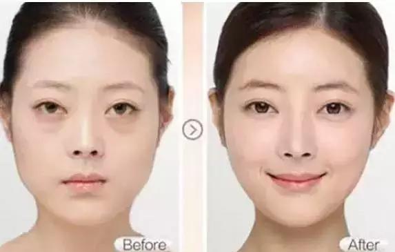 眼周有细纹用什么眼霜好用,护理眼周先用眼精华还是先用眼霜