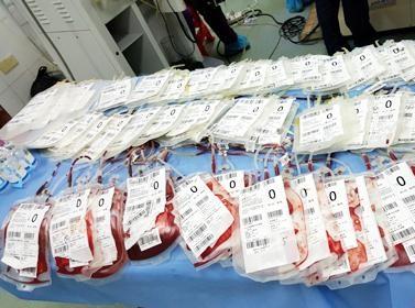 产房急救故事：16块纱布塞进子宫，怎么就挽救了孕妇的生命？