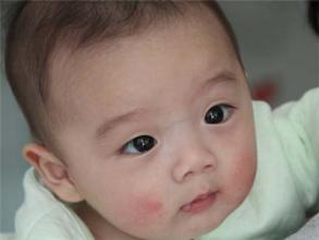 秋冬季节如何保护宝宝的皮肤,儿童冬天怎么保护皮肤