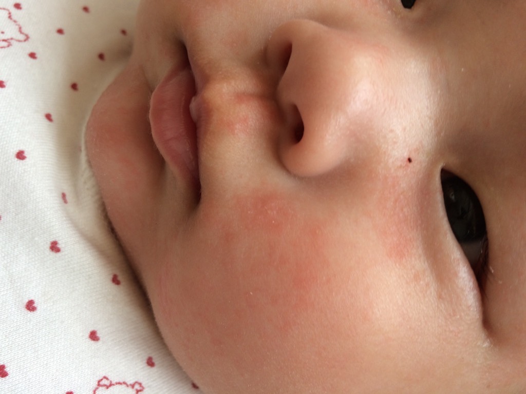 秋冬季节如何保护宝宝的皮肤,儿童冬天怎么保护皮肤