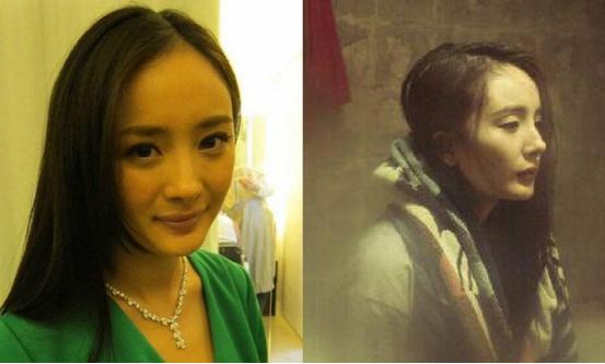 哪些女星整过发际线,发际线最惊人的女星