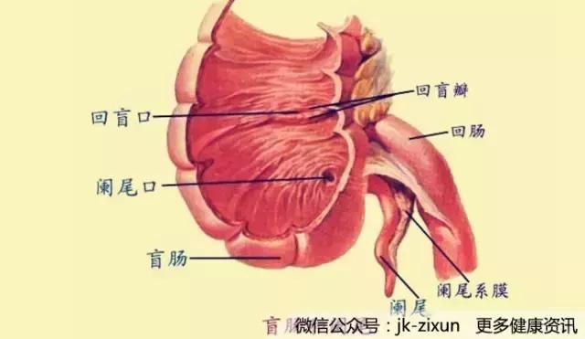 阑尾炎可以割也可以不割吗,阑尾炎一定要做手术吗