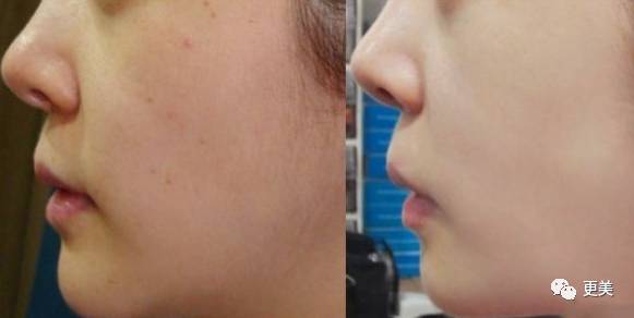 卖劣质面膜的明星,明星卖假化妆品后续