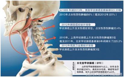 甲状腺瘤同甲状腺癌有什么区别,甲状腺瘤是甲状腺癌吗