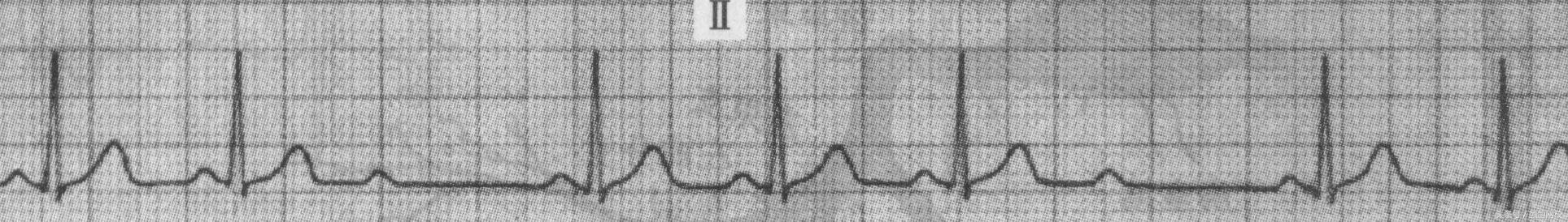 郭雅卿心电图讲解全集,郭雅卿心血管视频课