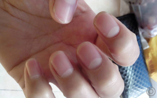 生育能力在身体哪个部位,女人查哪项看生育能力