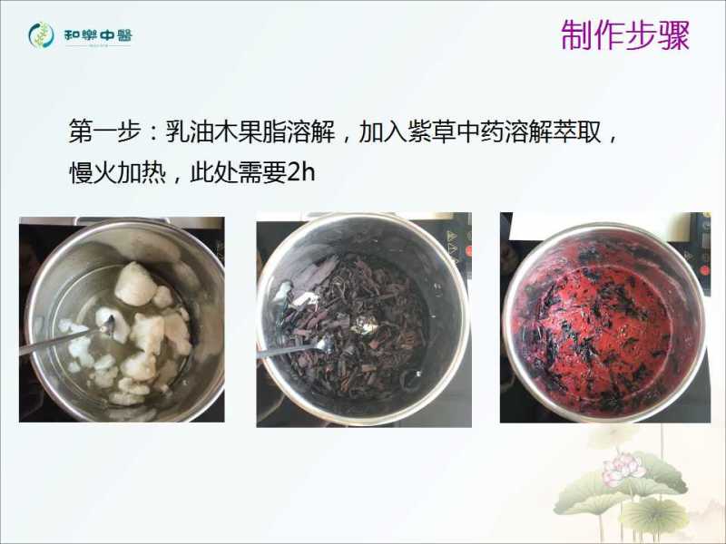 紫草膏治烧伤烫伤吗,治蚊虫叮咬止痒消肿软膏制作