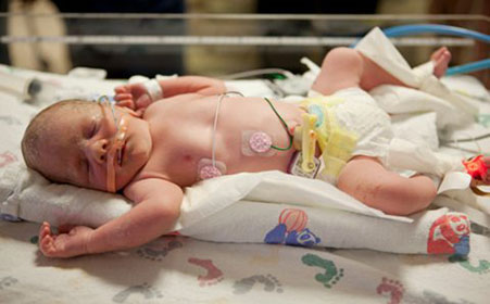 小孩老是用手揉眼睛的危害,小孩爱揉眼睛的原因