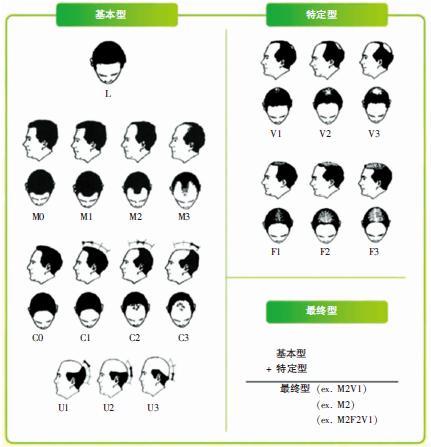 雄激素性脱发为什么叫脂溢性脱发,脂溢性脱发和雄激素脱发是一种吗